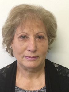 Blefaroplastica Superiore e Inferiore Torino